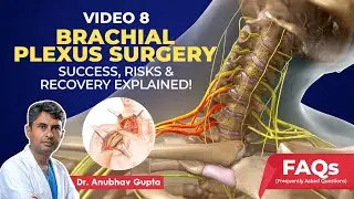 Brachial Plexus Surgery Explained: Success Rate, Recovery, Risks & More | Dr. Anubhav Gupta