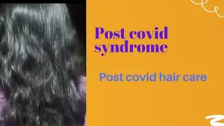 post covid syndrome, post covid hair fall management