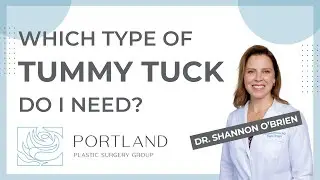 Which type of tummy tuck do I need?