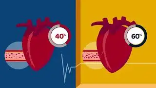 Living with Heart Failure