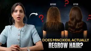 Minoxidil for Hair Growth: Before Using It, Watch This