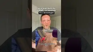💥 Через 24 часа после проведения дерматологом лазерной обработки лица и век!