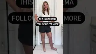 Lipedema Awareness