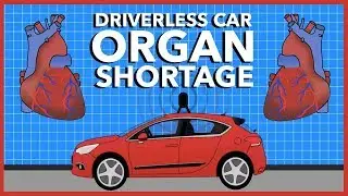 Will Driverless Cars Cause an Organ Shortage?