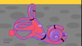 Autophony in Superior Canal Dehiscence Syndrome
