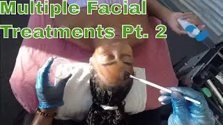 How to do Multiple Facial Treatments, Extractions, Dermaplaning, Peels, & Moisturizer Part 2