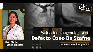 Evaluaci&oacute;n Imagenol&oacute;gica del Defecto &Oacute;seo de Stafne
