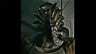Alien: Romulus (2024) | Xenomorph Baby Alien 👽 Attack On Navarro🔥☠️ #shorts