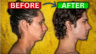 Does thumbpulling really works or not.