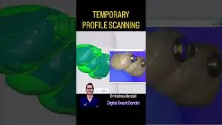 TEMPORARY SCANNING & AI! Thanks medit! #intraoralscanning #digitaldentistry