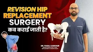 Hip Pain Repeat? 😱 Revision Total Hip Replacement Ka Solution Dekho!