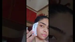 acsolve gel 🍀 #acneproneskin #acnetreatment #antiagingcream #gel #sensitiveskin #shorts #viral