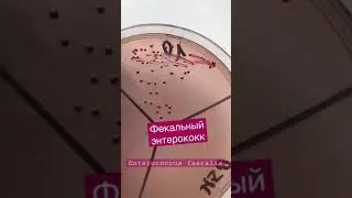 Фекальный энтерококк Enterococcus faecalis на чашке Петри