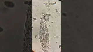 #hungry #bdelloid #rotifer gets busy #feeding ( #biology #life #lifescience #microscopy )
