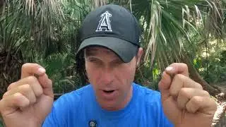 Hidden Causes of Post-Exertion Malaise (PEM)
