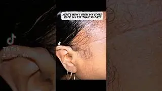 Here&rsquo;s How I Grew My Edges Back In Less Than 30 Days #shorts #viralvideo #video #fyp #shortvideo #fy