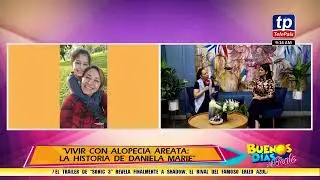 BDMG - VIVIR CON ALOPECIA AREATA: LA HISTORIA DE DANIELA MARIE