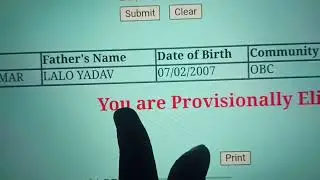 #NR अप्रेंटिस You are Not Provisionally Eligible 😱 You are Provisionally Eligible 😊 क्या होगा अब?