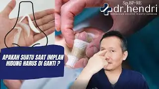 APAKAH IMPLAN HIDUNG HARUS DIGANTI ?!