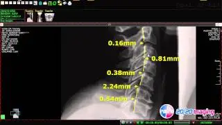 20 20 Imaging Opal Rad Chiropractic Software Tools