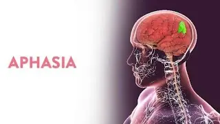 Aphasia Causes Symptoms Types