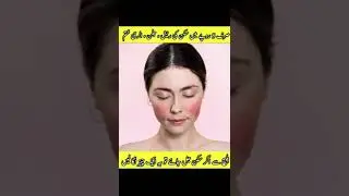 Bleach se skin jal jaye to kya kare || Bleach reaction treatment in one day || Skin burn treatment