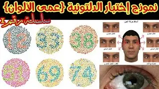 نموذج إختبار الدلتونية 