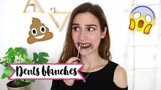 4 astuces BIZARRES pour BLANCHIR LES DENTS !