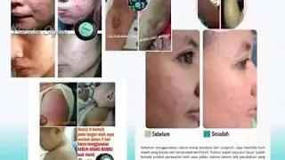 Longrich Products - Indonesia