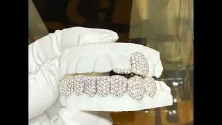Custom Moissanite Grillz That Pass the Diamond Tester 💎 | 8 Bottom 2 Top