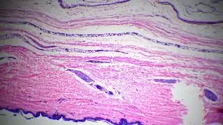 Microscopic 40x view of human skin with shown sweat glands against bright field