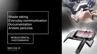 SMILE LITE MDP2 - MOBILE DENTAL PHOTOGRAPHY BY PROF. LOUIS HARDAN