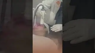 POV: Experience the Power of Vivace Skin Resurfacing | Illumis Aesthetic Clinic