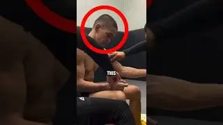 Последствия быстрого похудения!