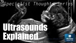 Ultrasounds Explained | Specialist Thoughts Series