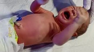 Newborn Baby Head-to-Toe Assessment | Complete Neonatal Examination 👶🩺