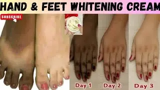 🌟 Hand & Feet Whitening with DIY  Home Remedy @DaclliSkincare