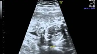 IMG 20120402 1 7