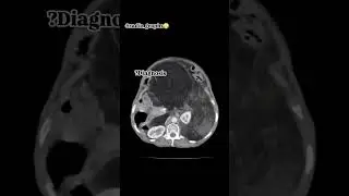 3dct abd #anatomy #ctscan #xray #doctor #nurse #viral #tranding #mri #science #student #study #xray