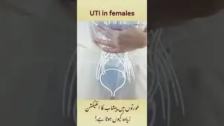 Why urinary tract infections are common in women? #uti #urine #women #ckd