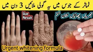 DIY Urgent whitening Home remedy | Hands and feet whitening at home | skin whitening at home 