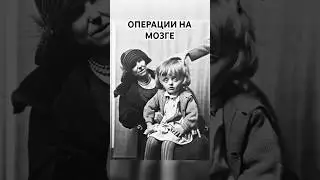 Операции на мозге! Добейте 100 подписчиков 🫶#прошлое #фото #история #photography #history