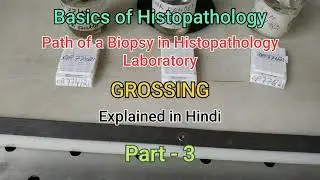 GROSSING explained in Hindi #histopathology #biopsy #tissueprocessing #grossing #labtechnicianjobs