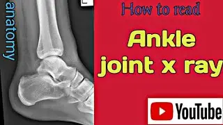 How to read Ankle joint X-Ray ।Anatomy of Ankle joint । Uday Xray