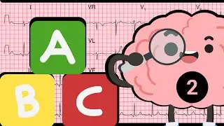 ABC del electrocardiograma: Principios fundamentales que debes conocer ( parte 02)