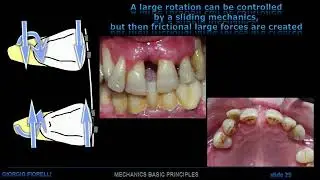 C. of Resistance  and Friction