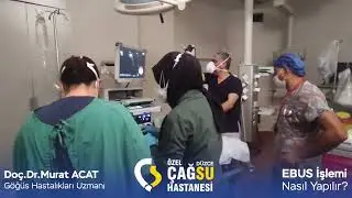 EBUS işlemi nasıl yapılır ?
