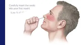 SARS-CoV-2 Patient Collected Nasal Specimen Collection Guide