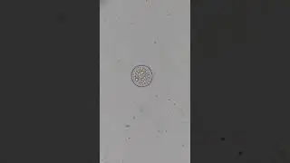 Ciliate comes out of it&acute;s cyst (part 1)  #microscopy #science