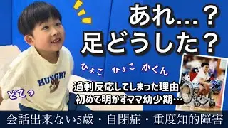 知的障害児を育てる難しさに直面しました…。【足の異変に気がついた日】　自閉症＋重度知的障害　うちのはるなり　5歳